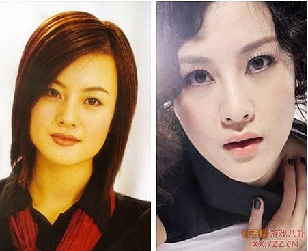 娱乐圈女明星大饼脸惊变锥子